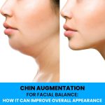 CHIN AUGMENTATION FOR FACIAL BALANCE : HOW IT CAN IMPROVE OVERALL APPEARANCE