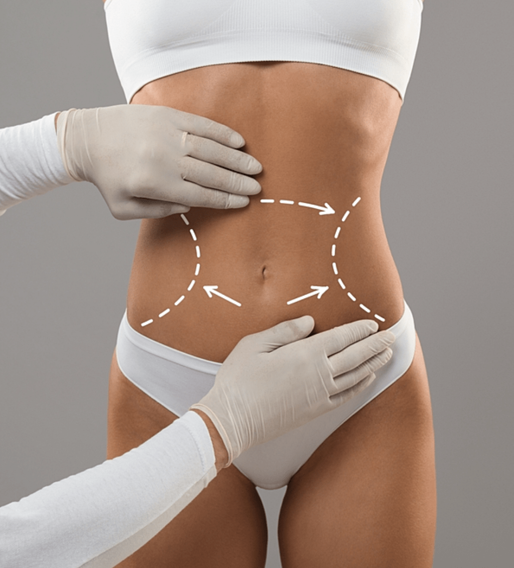 360 Waist Contouring at Sculpt Sublime Clinic, the best cosmetic surgery and plastic surgery clinic in Mumbai