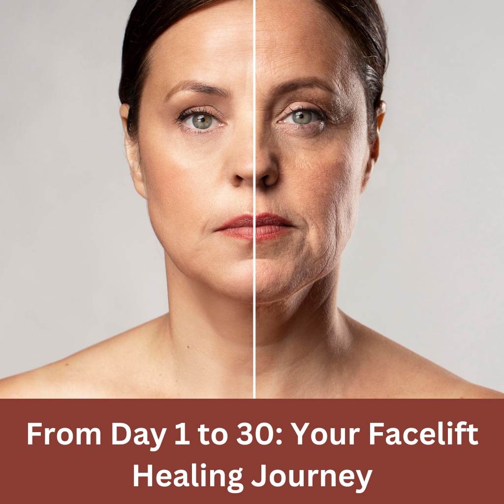 Facelift Healing Journey