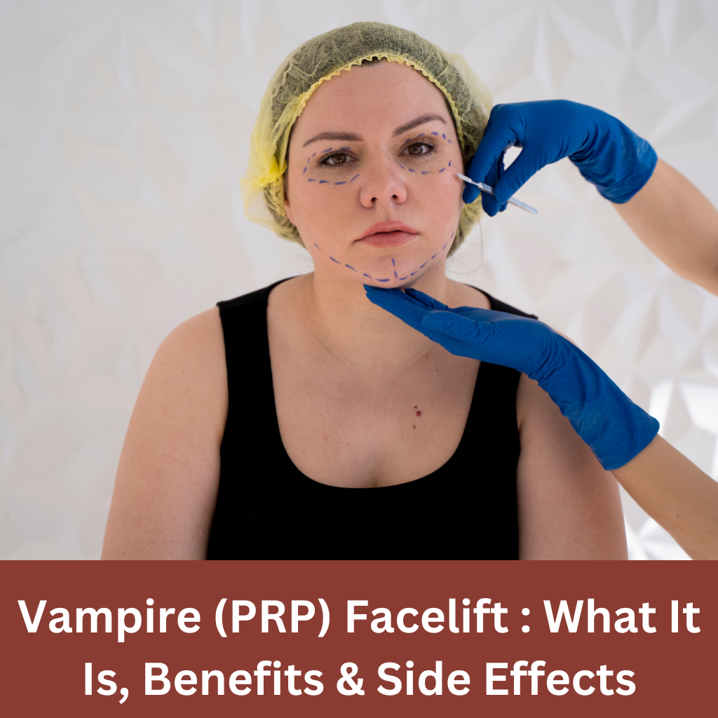 Vampire (PRP) Facelift