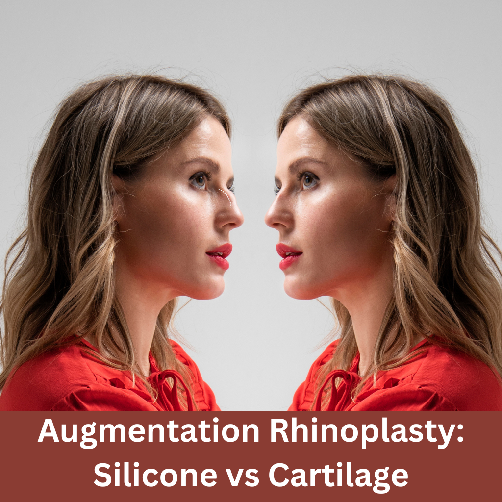 Rhinoplasty: Silicone vs. Cartilage