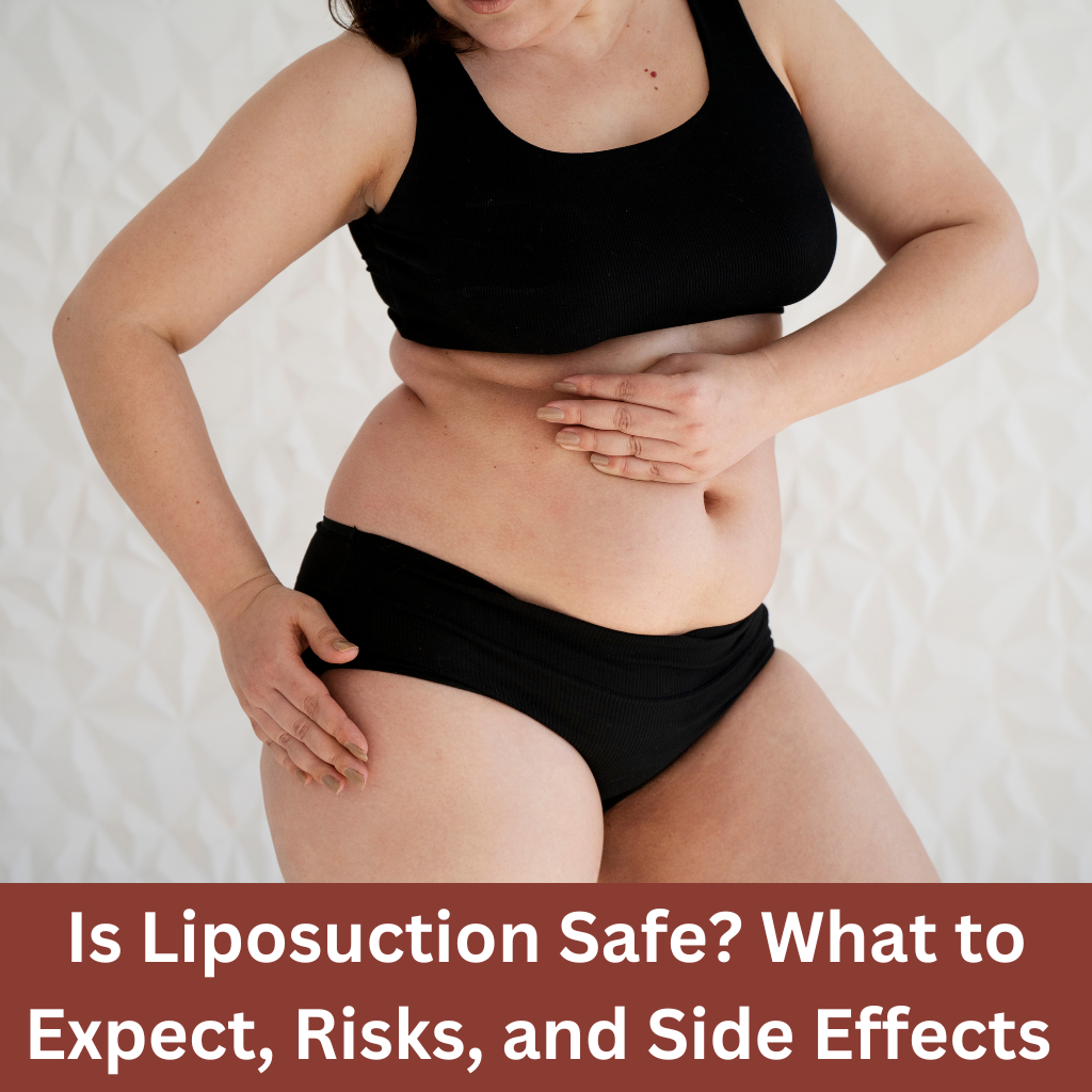 All about liposuction surgery