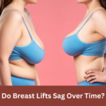 Do Breast Lifts Sag Over Time?