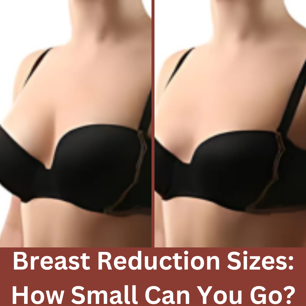 Before and after comparison of a woman's chest, illustrating the results of breast reduction surgery for more proportional and comfortable breast size.