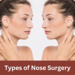 Types of Nose Surgery