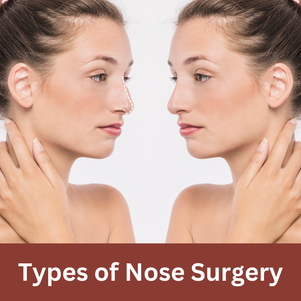 Side profile comparison of a woman before and after nose surgery, highlighting the changes in her nose shape.