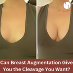 Can Breast Augmentation Give You the Cleavage You Want?