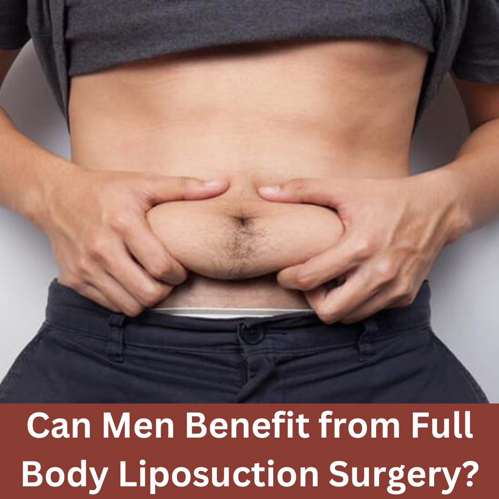 Man examining abdominal fat before liposuction surgery