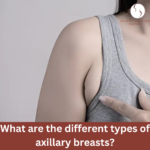 What are the different types of axillary breasts?